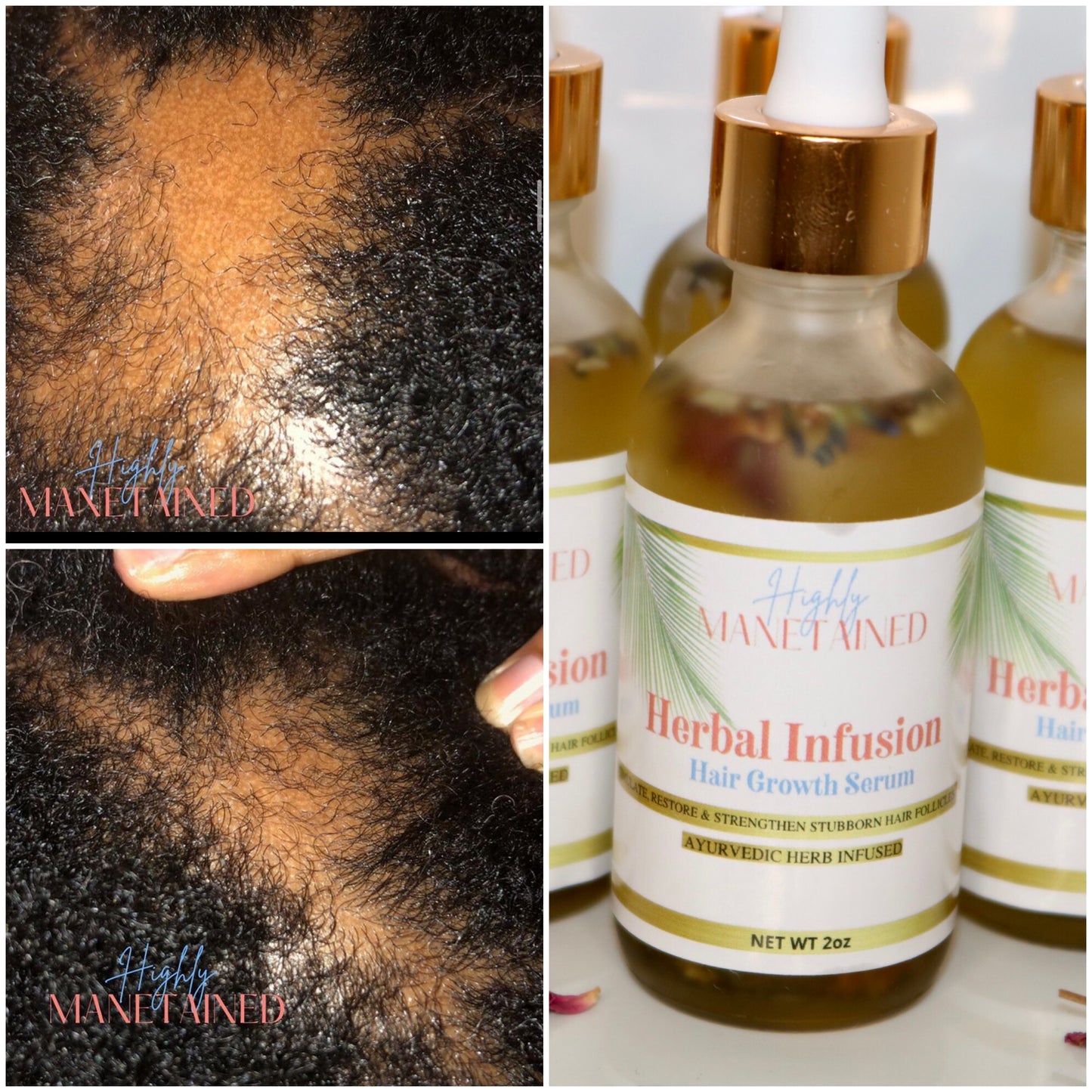 “ Herbal Infusion “ Growth Serum